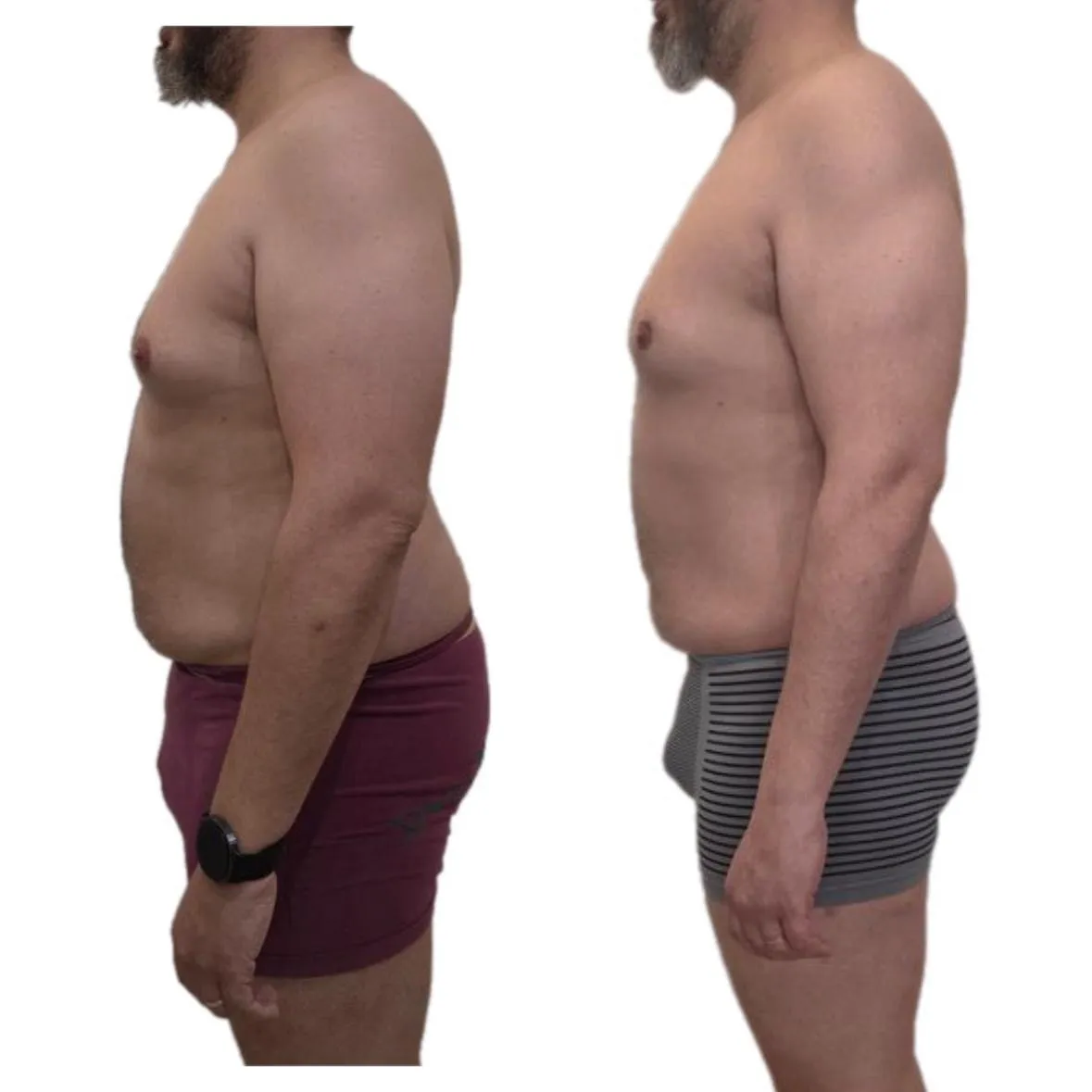 Transformación de Adri: resultado final, -6 kg de grasa en 3 meses