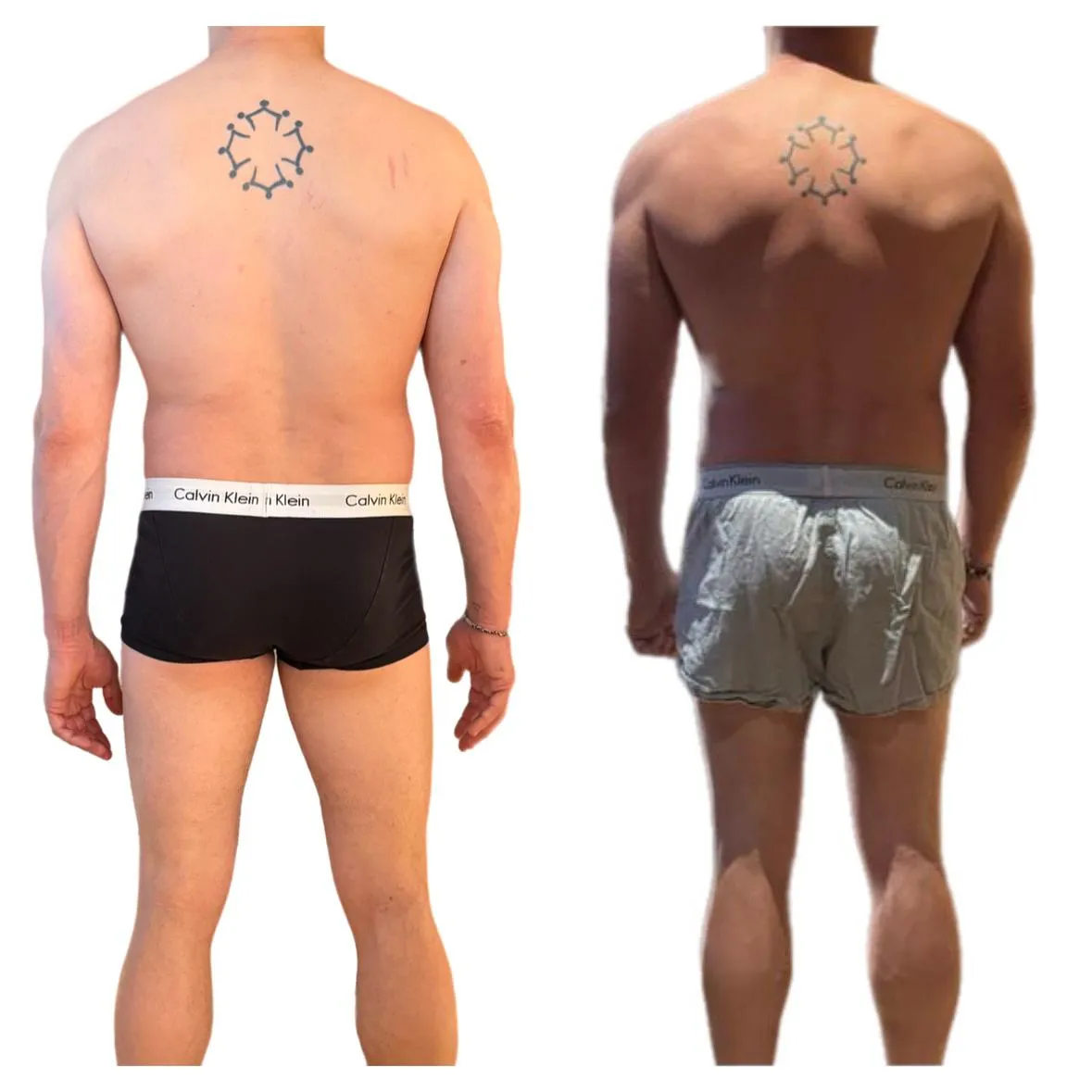 Transformación de Carlos: progreso adicional tras cirugía lumbar